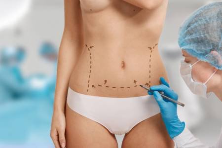 Vücut Şekillendirme ve Liposuction Rehberi